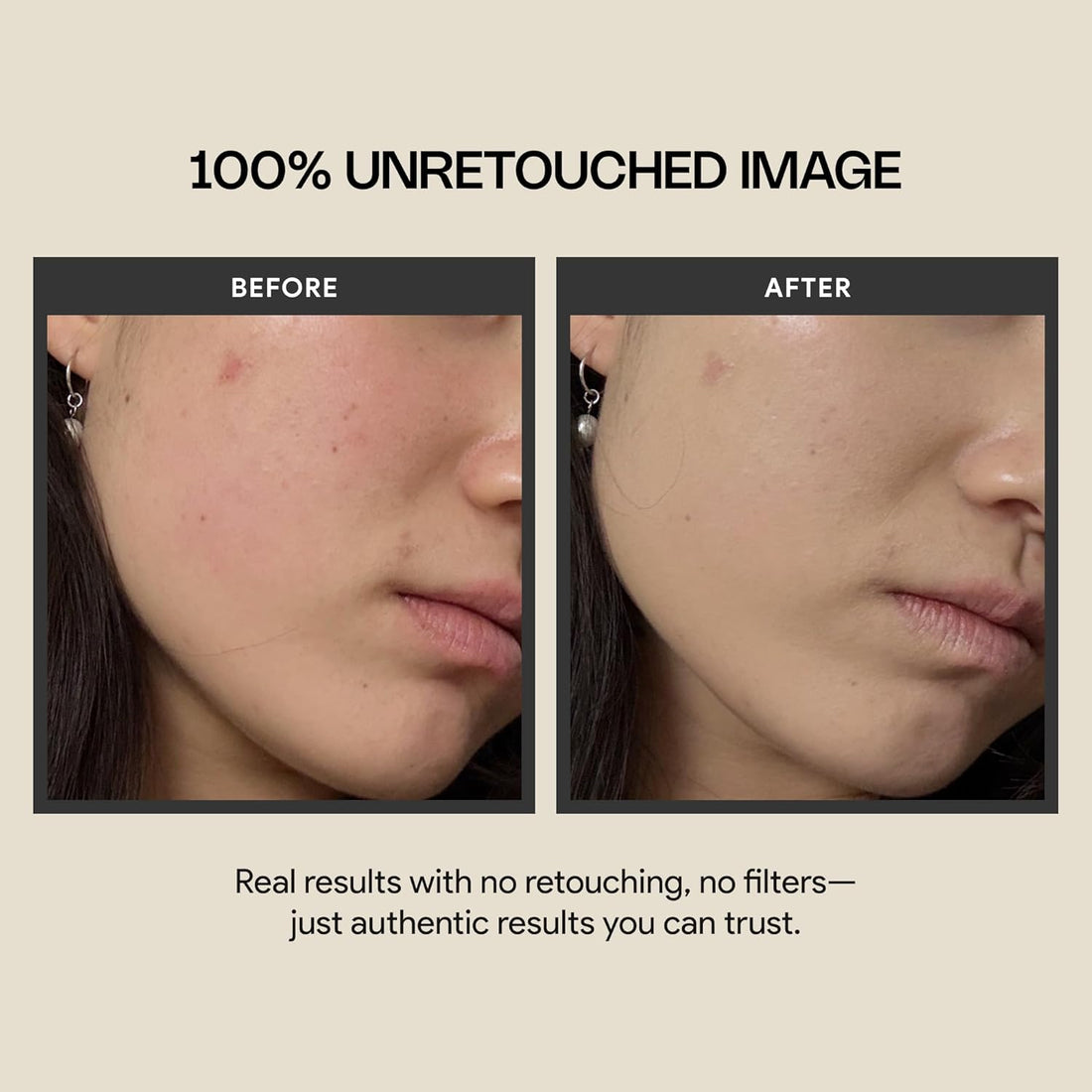 Cica Redness Solution Cream Lite