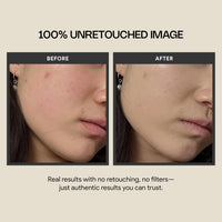 Cica Redness Solution Cream Lite