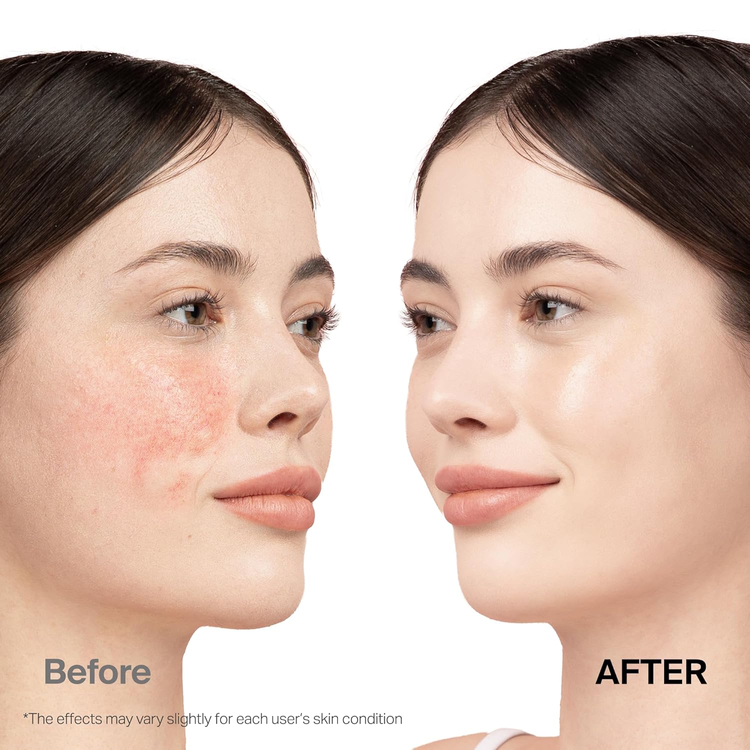 Cica Redness Solution Sunscreen – Meebak