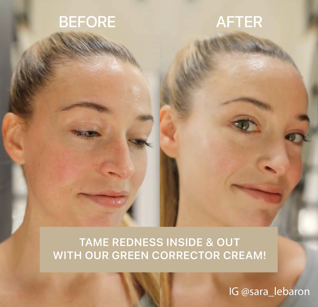 Cica Redness Solution Cream