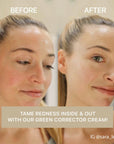 Cica Redness Solution Cream