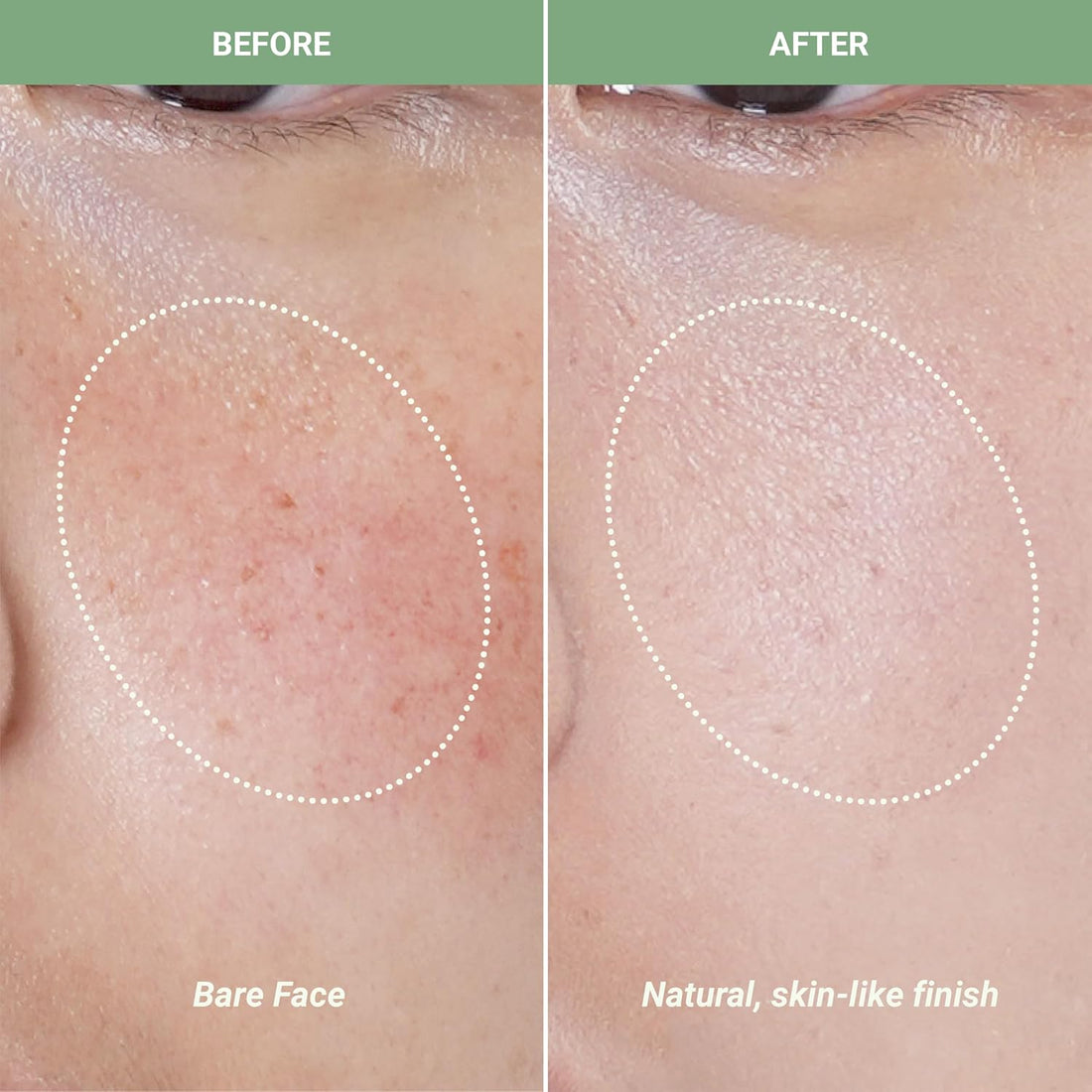 Cica Redness Solution Cream