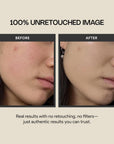 Cica Redness Solution Cream Lite