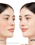 Cica Redness Solution Sunscreen